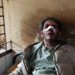 নির্বাচনী প্রচারনার প্রথম দিনে লক্ষ্মীপুরে বিএনপি-জামায়াতের মারামারি: আহত-৪